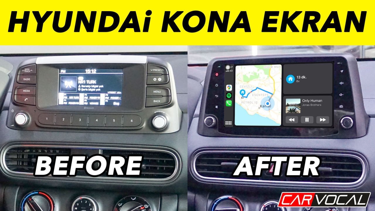 Hyundai Kona Multimedya Sistemi